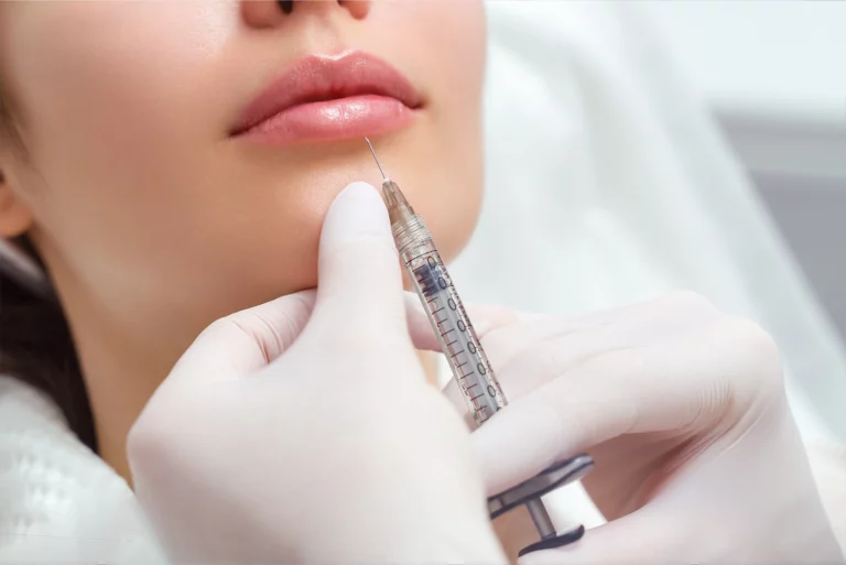 Filler Dissolver cosmetic clinic perth skincare injections