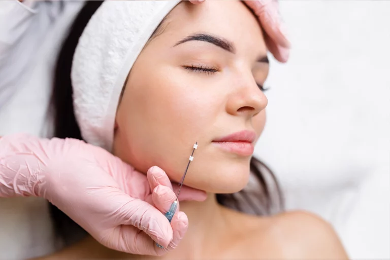 Silhouette Soft Threads cosmetic clinic perth skincare Dr Tammy