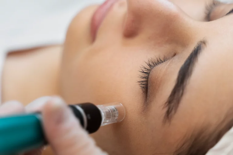 Skin Needling cosmetic clinic perth skincare Injections