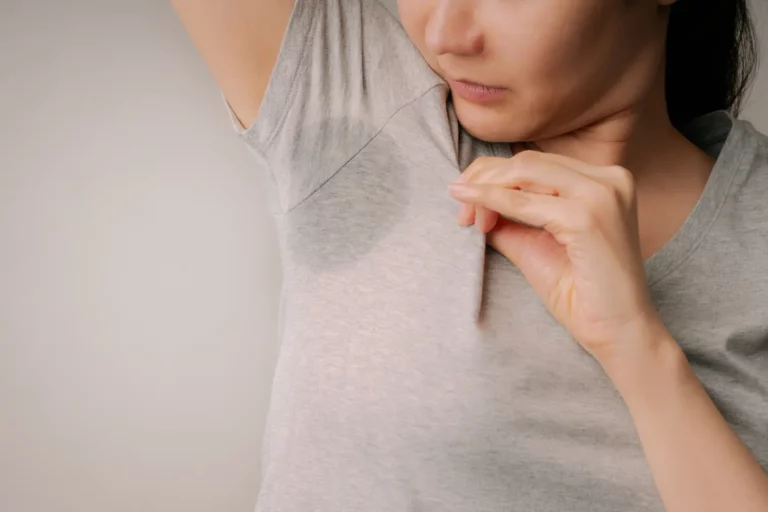 excessive sweating treatments perth everything skin